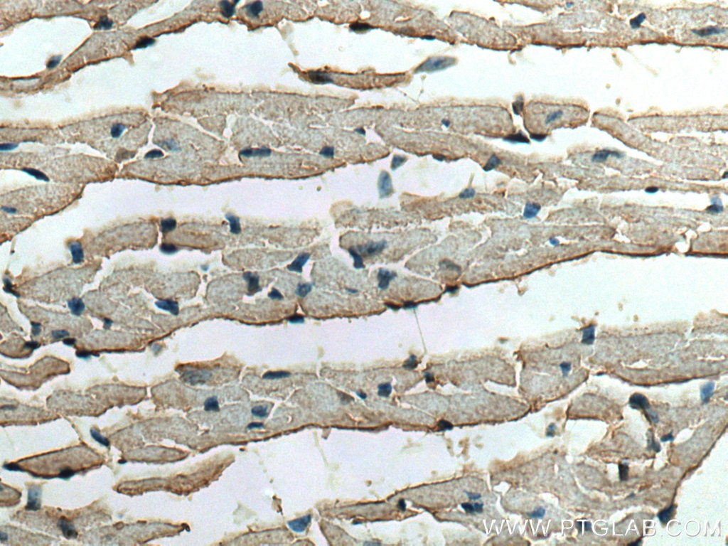 Immunohistochemistry (IHC) staining of mouse heart tissue using RHOBTB3 Polyclonal antibody (13945-1-AP)