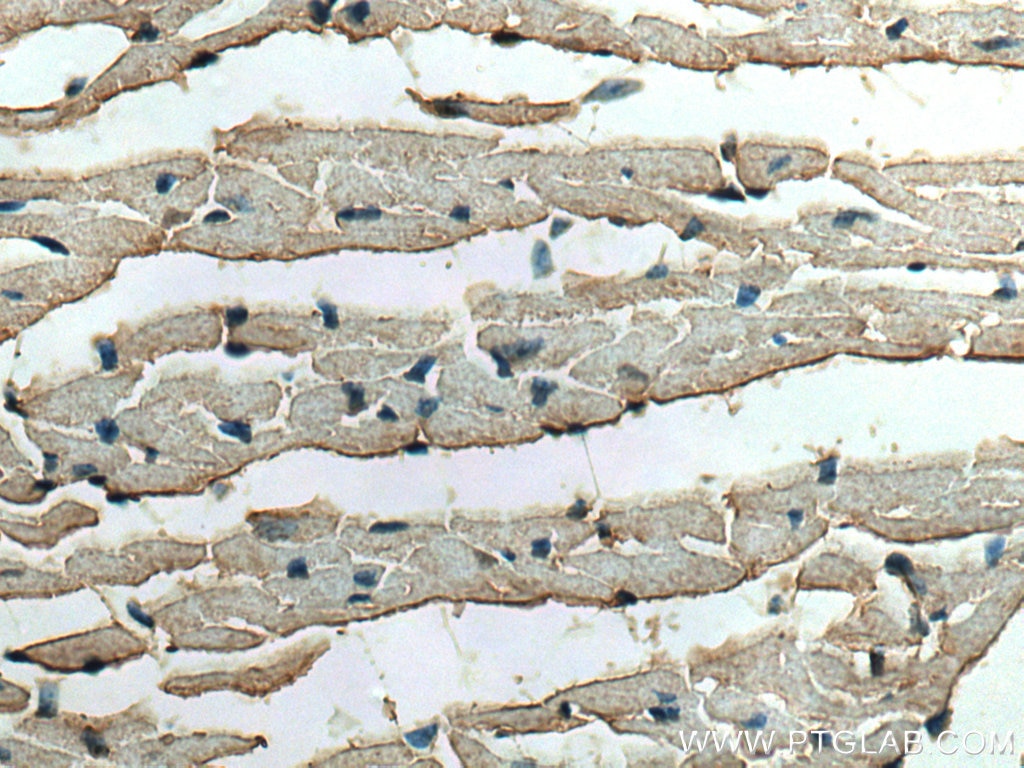 IHC staining of mouse heart using 13945-1-AP