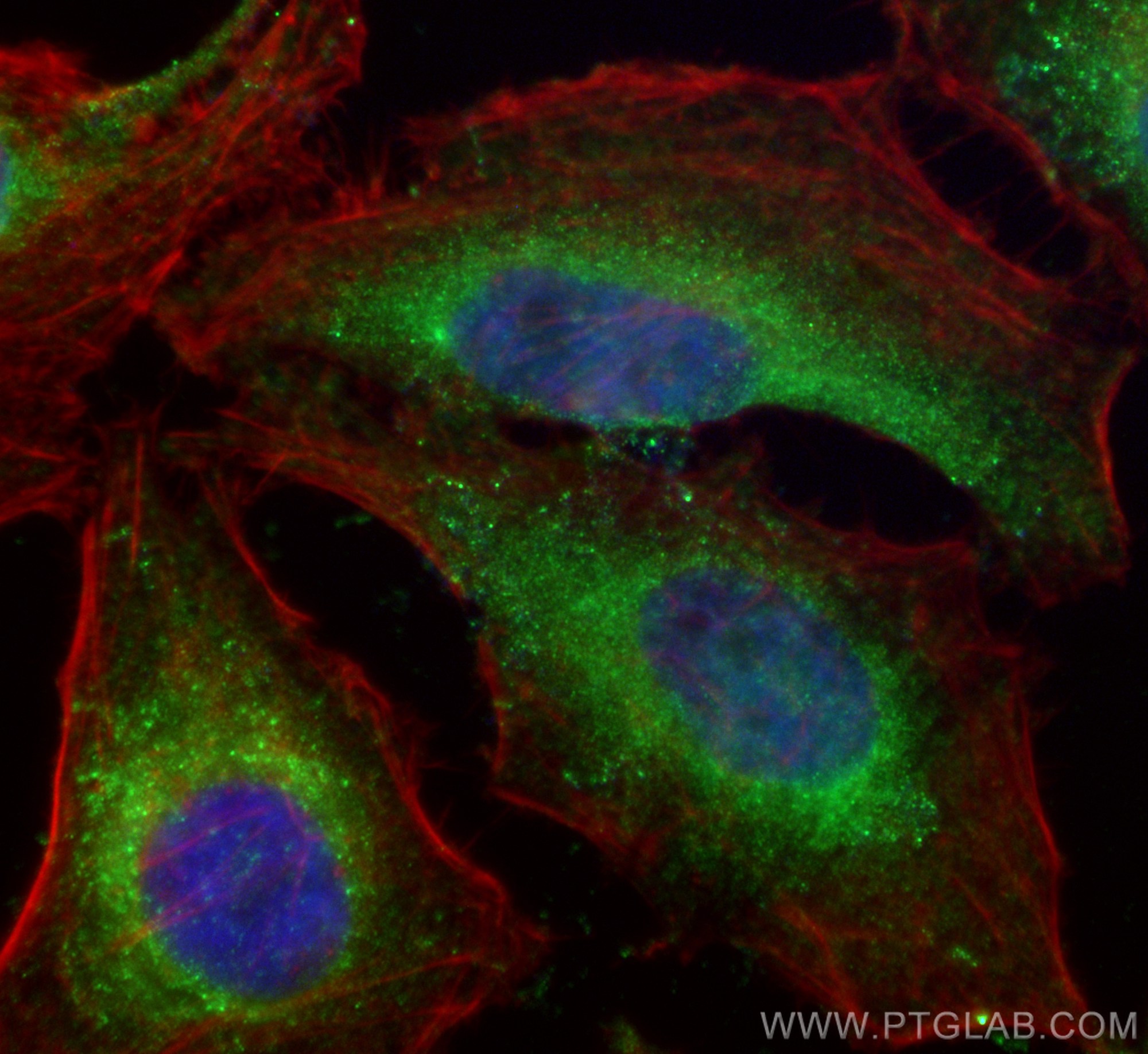Immunofluorescence (IF) / fluorescent staining of HeLa cells using RHOBTB3 Monoclonal antibody (67502-1-Ig)