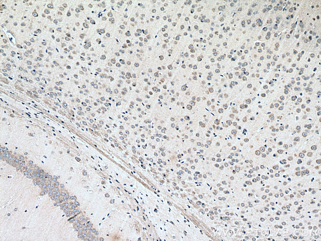 Immunohistochemistry (IHC) staining of mouse brain tissue using RHOBTB3 Monoclonal antibody (67502-1-Ig)