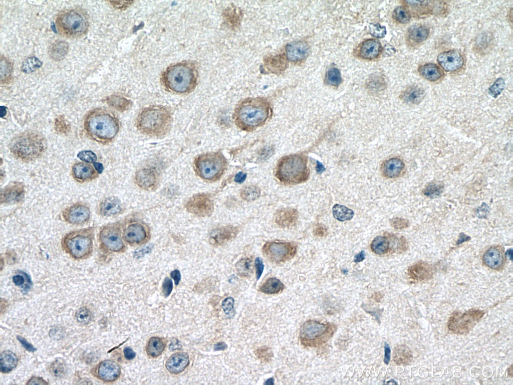 Immunohistochemistry (IHC) staining of mouse brain tissue using RHOBTB3 Monoclonal antibody (67502-1-Ig)