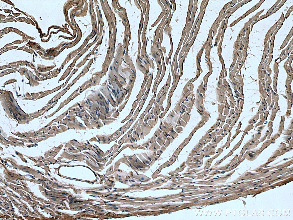 Immunohistochemistry (IHC) staining of mouse heart tissue using RHOBTB3 Monoclonal antibody (67502-1-Ig)