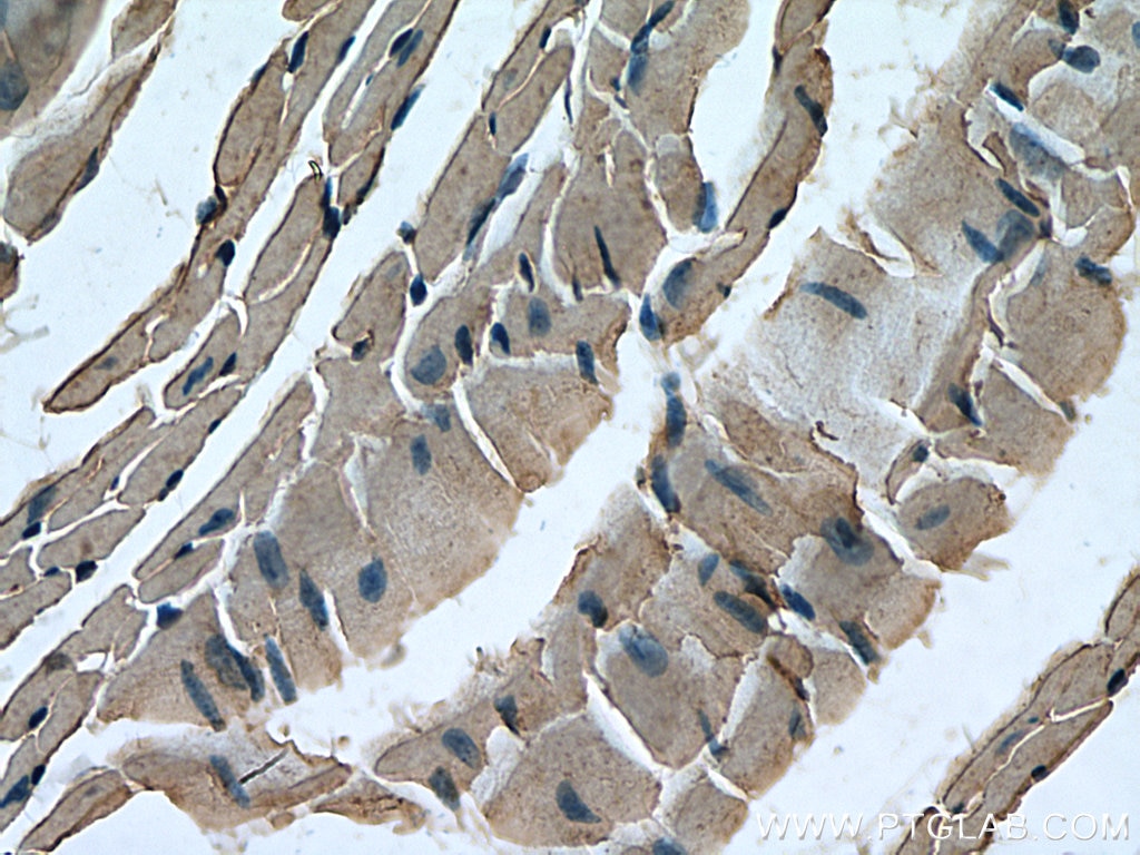 Immunohistochemistry (IHC) staining of mouse heart tissue using RHOBTB3 Monoclonal antibody (67502-1-Ig)