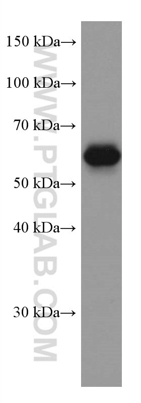 Western Blot (WB) analysis of U2OS cells using RHOBTB3 Monoclonal antibody (67502-1-Ig)