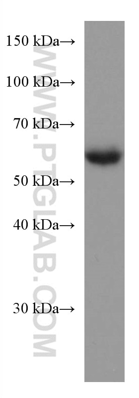 Western Blot (WB) analysis of HeLa cells using RHOBTB3 Monoclonal antibody (67502-1-Ig)