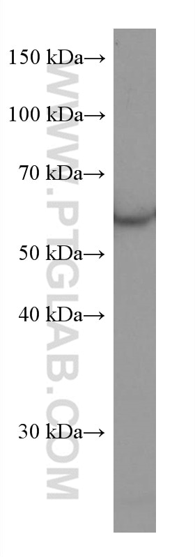 Western Blot (WB) analysis of Jurkat cells using RHOBTB3 Monoclonal antibody (67502-1-Ig)
