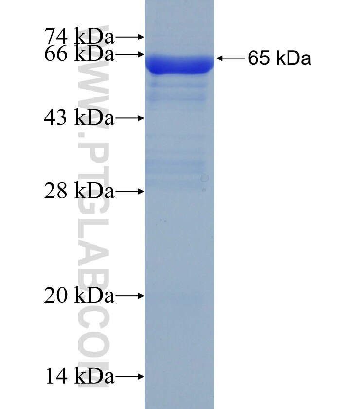 RHOBTB3 fusion protein Ag5025 SDS-PAGE
