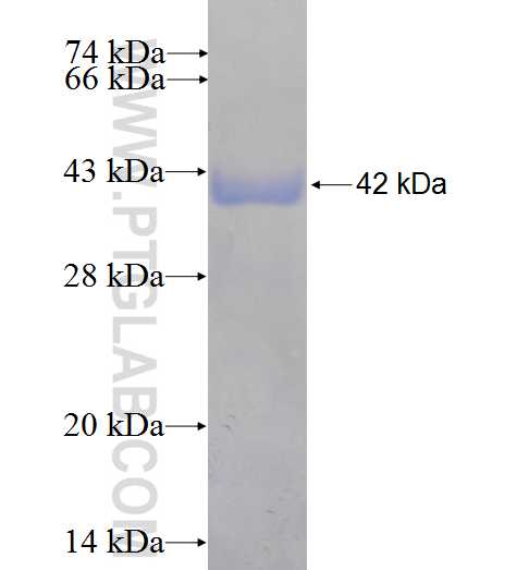 RHOBTB3 fusion protein Ag5782 SDS-PAGE