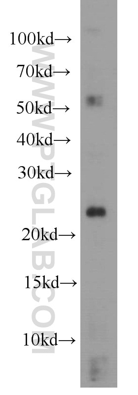 RHOC Polyclonal antibody