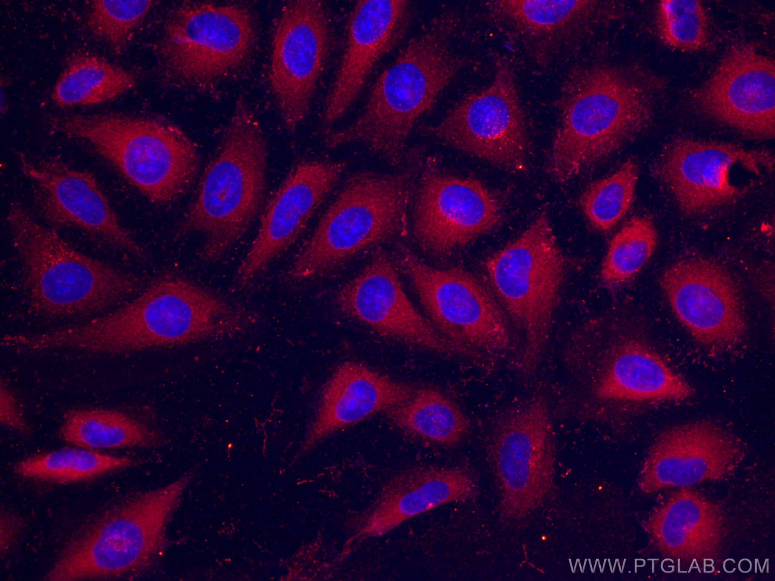 Immunofluorescence (IF) / fluorescent staining of HeLa cells using RHOC Monoclonal antibody (67542-1-Ig)