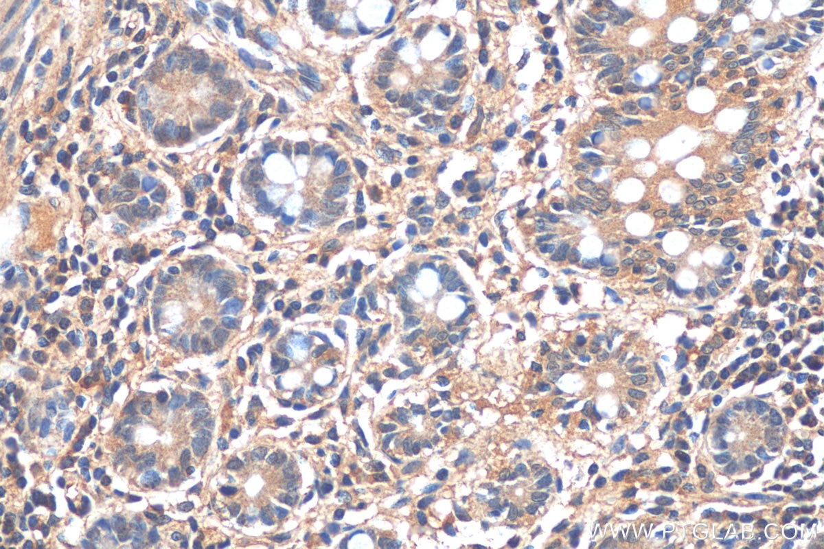 Immunohistochemistry (IHC) staining of human small intestine tissue using RHOC Monoclonal antibody (67542-1-Ig)