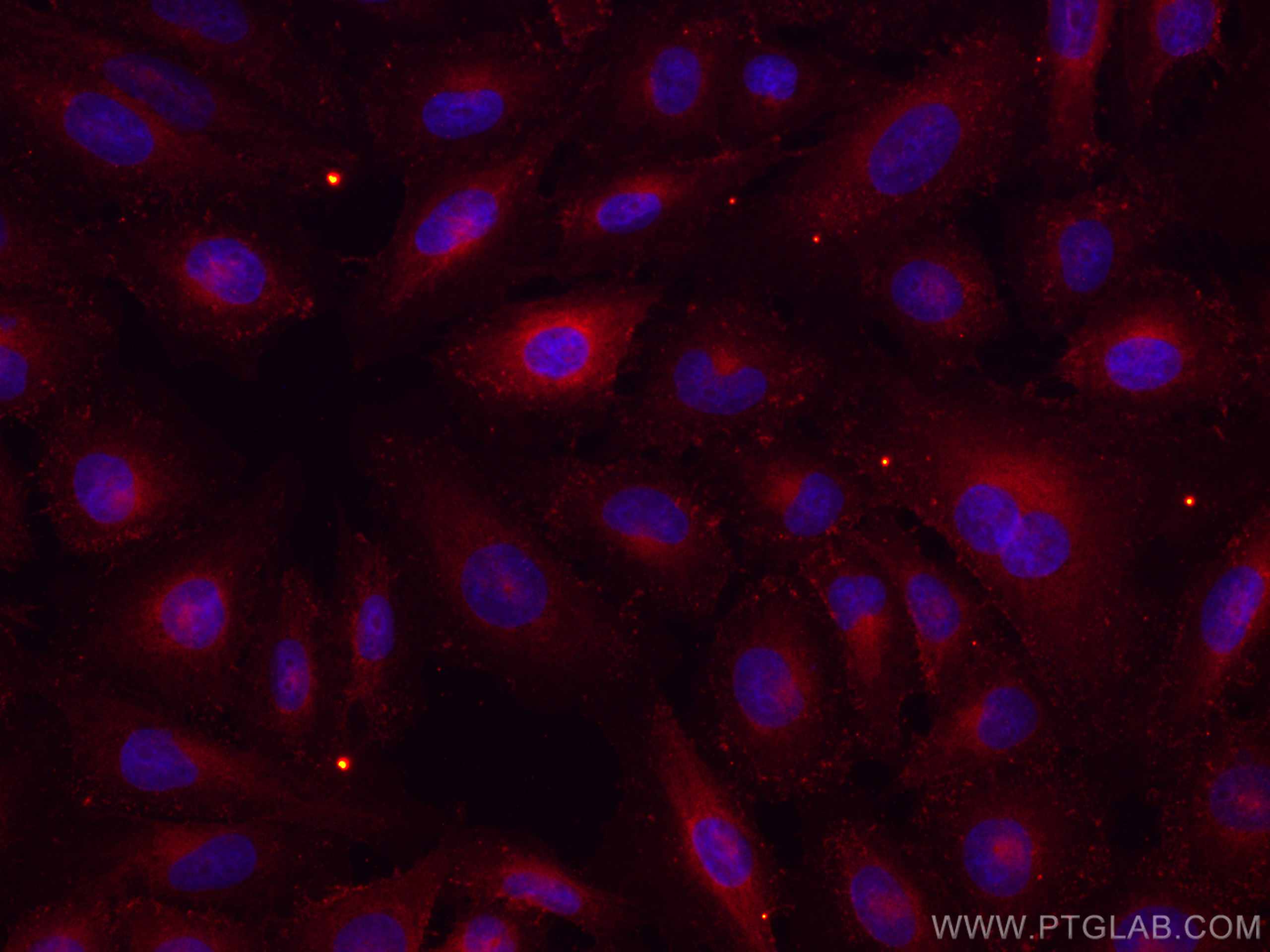 Immunofluorescence (IF) / fluorescent staining of HeLa cells using CoraLite®594-conjugated RHOC Monoclonal antibody (CL594-67542)