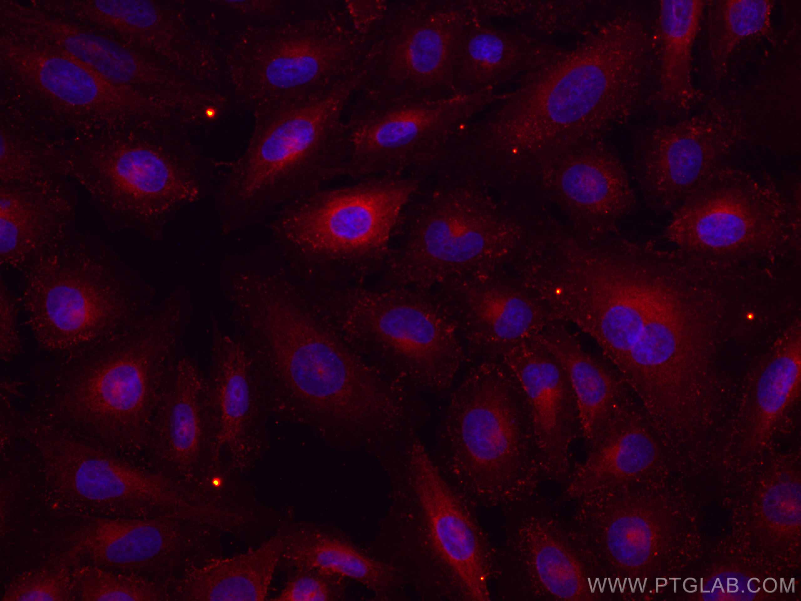 IF Staining of HeLa using CL594-67542