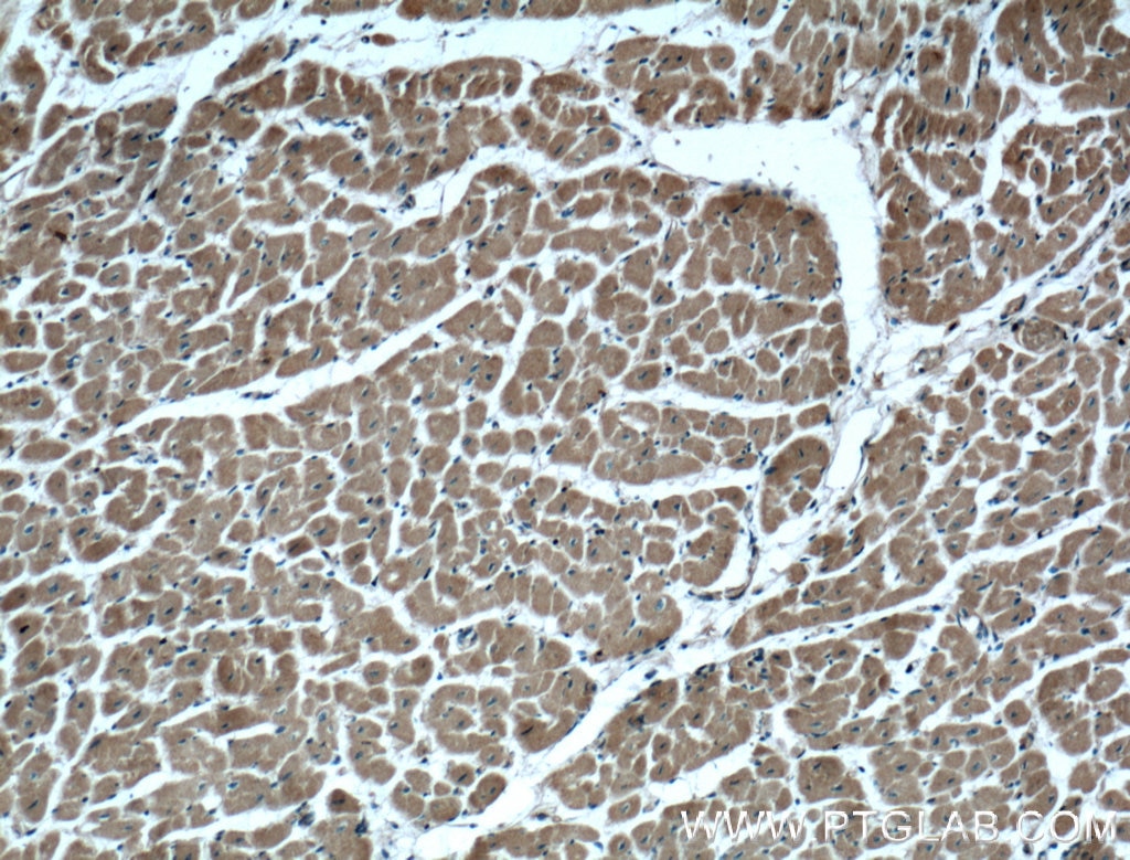 IHC staining of human heart using 11717-1-AP