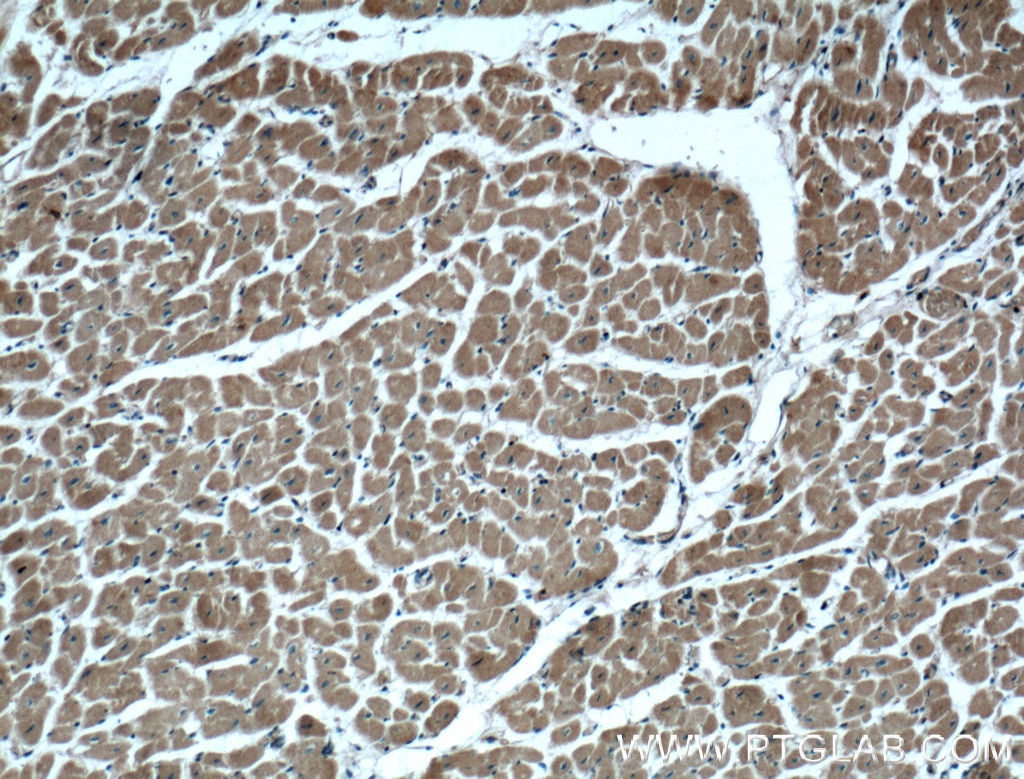 Immunohistochemistry (IHC) staining of human heart tissue using RHOD Polyclonal antibody (11717-1-AP)