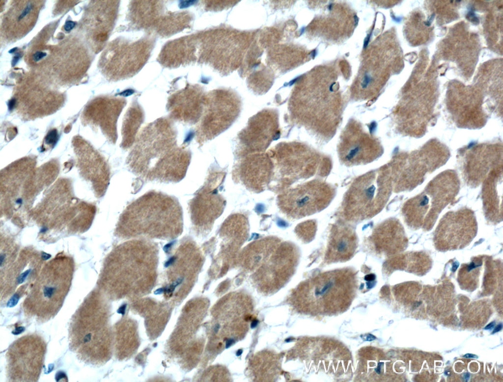 Immunohistochemistry (IHC) staining of human heart tissue using RHOD Polyclonal antibody (11717-1-AP)