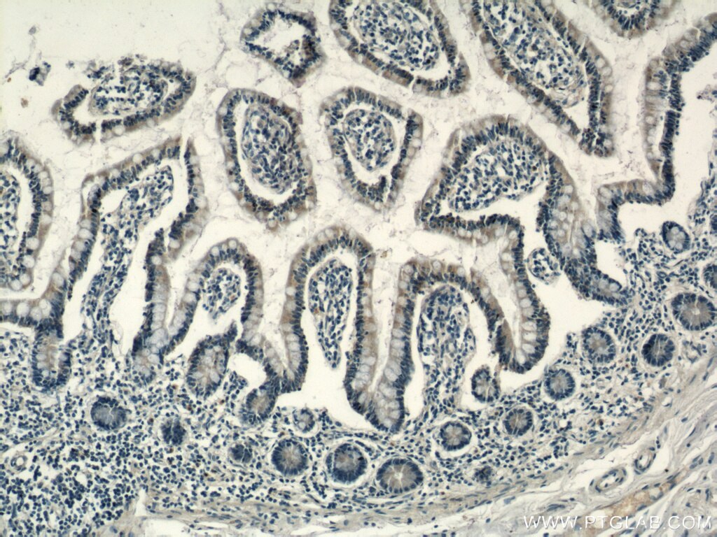 Immunohistochemistry (IHC) staining of human small intestine tissue using RHOF Polyclonal antibody (12290-1-AP)