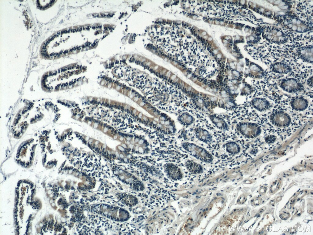 Immunohistochemistry (IHC) staining of human small intestine tissue using RHOF Polyclonal antibody (12290-1-AP)