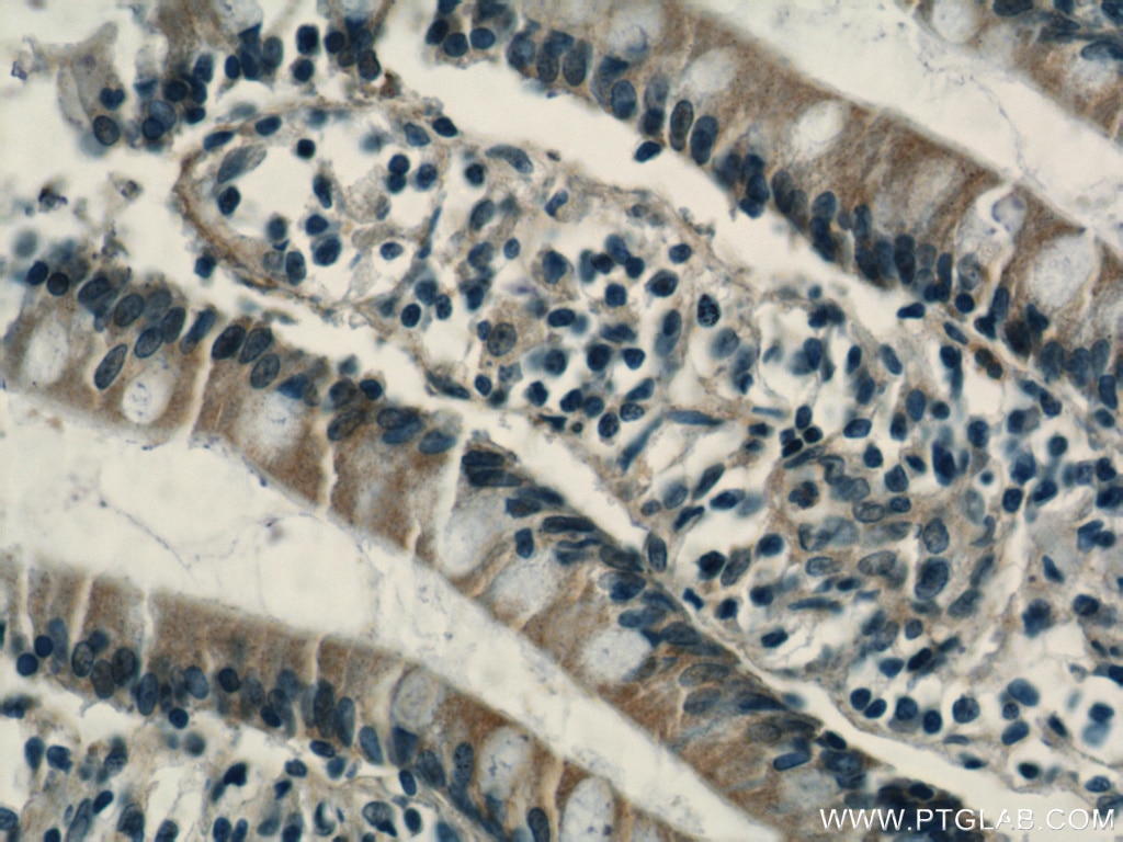 Immunohistochemistry (IHC) staining of human small intestine tissue using RHOF Polyclonal antibody (12290-1-AP)