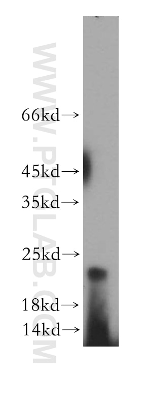 Western Blot (WB) analysis of human brain tissue using RHOF Polyclonal antibody (12290-1-AP)