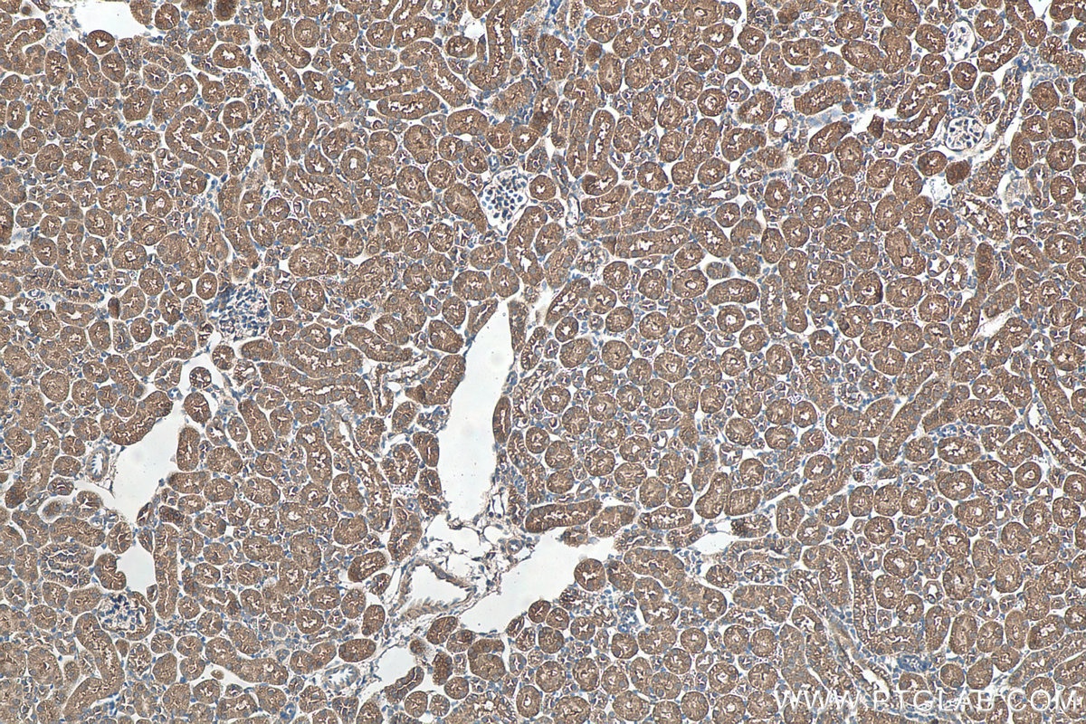Immunohistochemistry (IHC) staining of mouse kidney tissue using RHOG-Specific Polyclonal antibody (19671-1-AP)