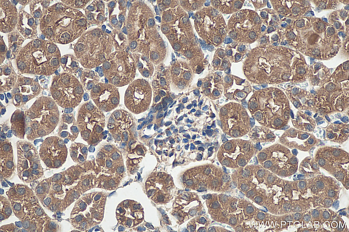 Immunohistochemistry (IHC) staining of mouse kidney tissue using RHOG-Specific Polyclonal antibody (19671-1-AP)