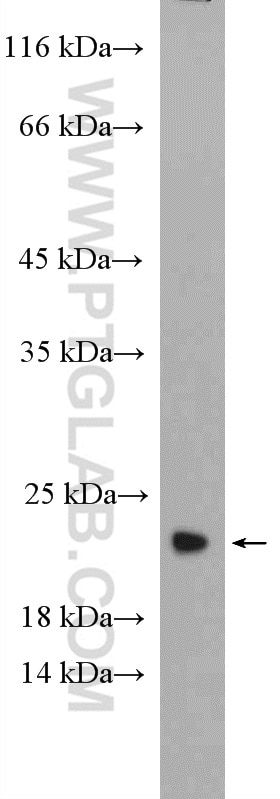 Western Blot (WB) analysis of C6 cells using RHOG-Specific Polyclonal antibody (19671-1-AP)