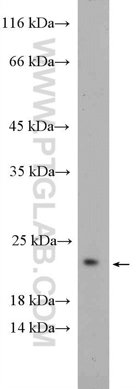 Western Blot (WB) analysis of Neuro-2a cells using RHOG-Specific Polyclonal antibody (19671-1-AP)