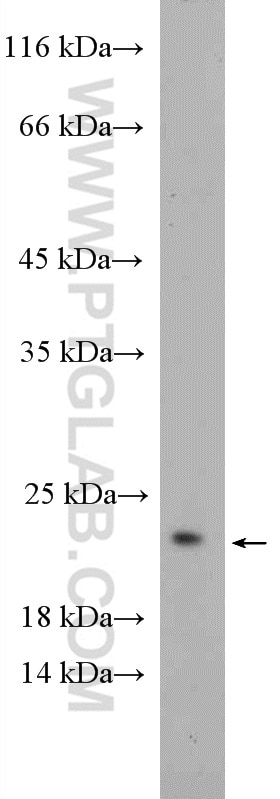 Western Blot (WB) analysis of Neuro-2a cells using RHOG-Specific Polyclonal antibody (19671-1-AP)