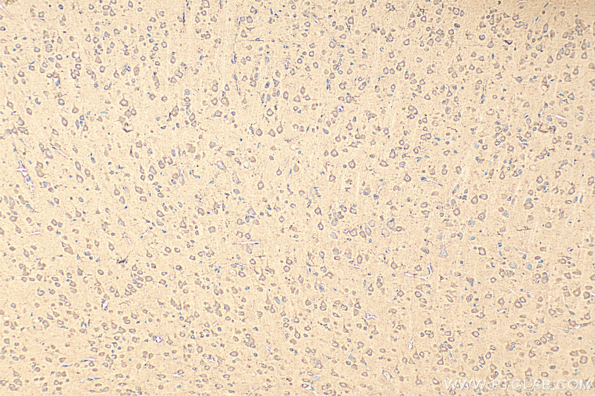 Immunohistochemistry (IHC) staining of rat brain tissue using RHOQ/TC10 Polyclonal antibody (17805-1-AP)