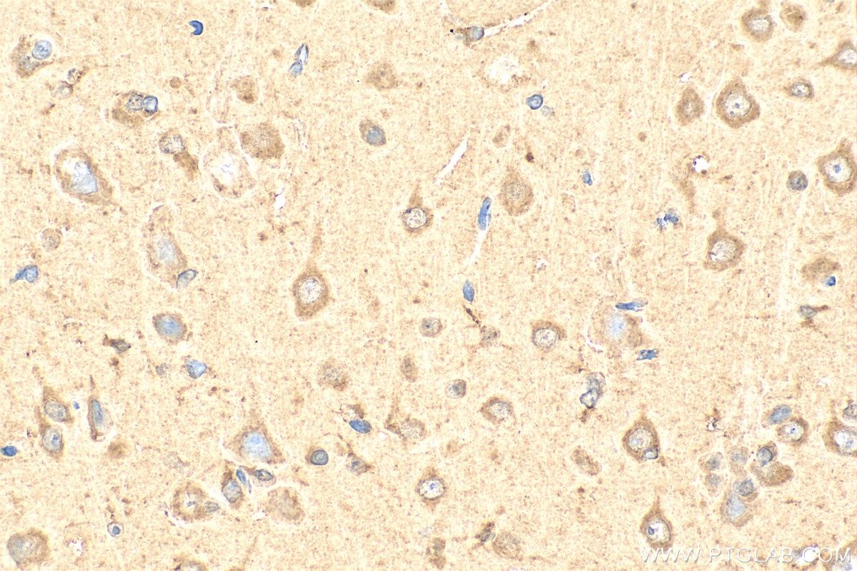 Immunohistochemistry (IHC) staining of rat brain tissue using RHOQ/TC10 Polyclonal antibody (17805-1-AP)
