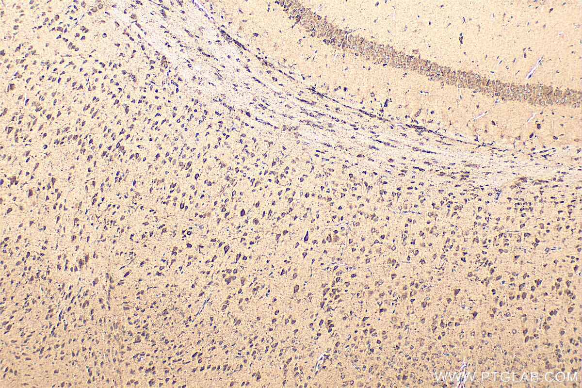 Immunohistochemistry (IHC) staining of mouse brain tissue using RHOQ/TC10 Polyclonal antibody (17805-1-AP)