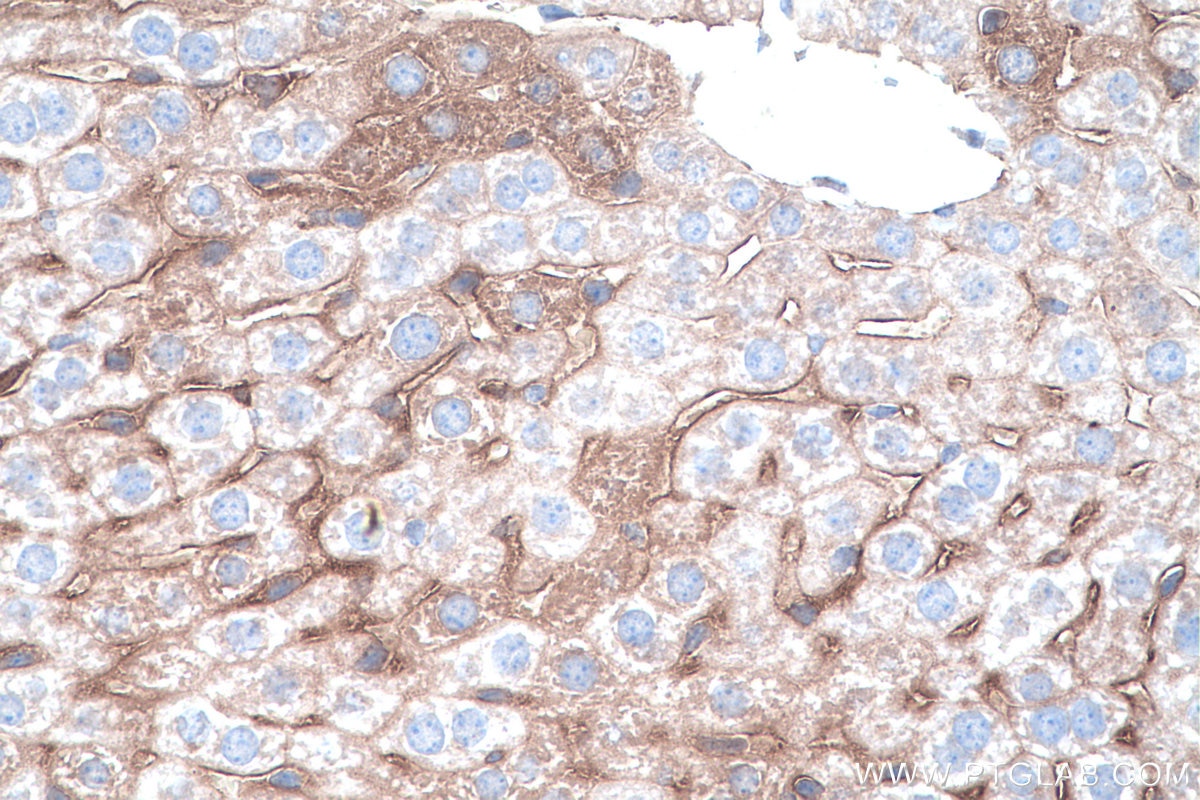 Immunohistochemistry (IHC) staining of mouse liver tissue using RHOQ/TC10 Monoclonal antibody (67213-1-Ig)