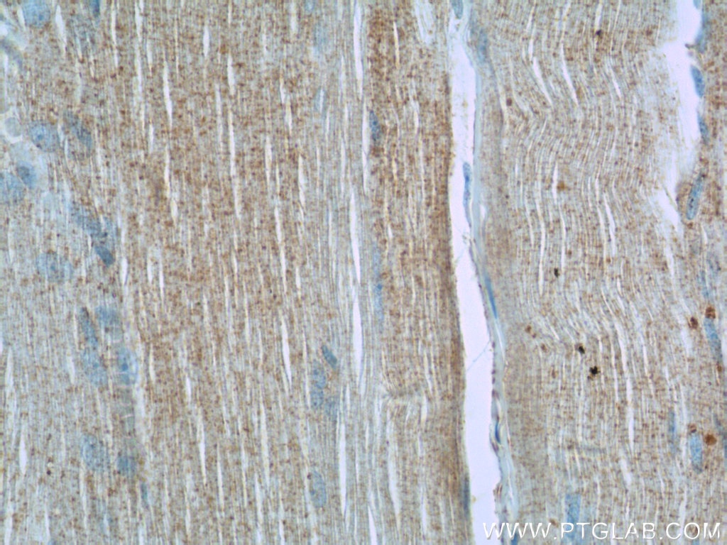 Immunohistochemistry (IHC) staining of human skeletal muscle tissue using RHOT1 Polyclonal antibody (21560-1-AP)