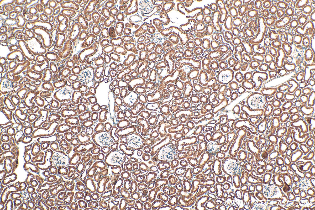 Immunohistochemistry (IHC) staining of mouse kidney tissue using MIRO1 Polyclonal antibody (21560-1-AP)