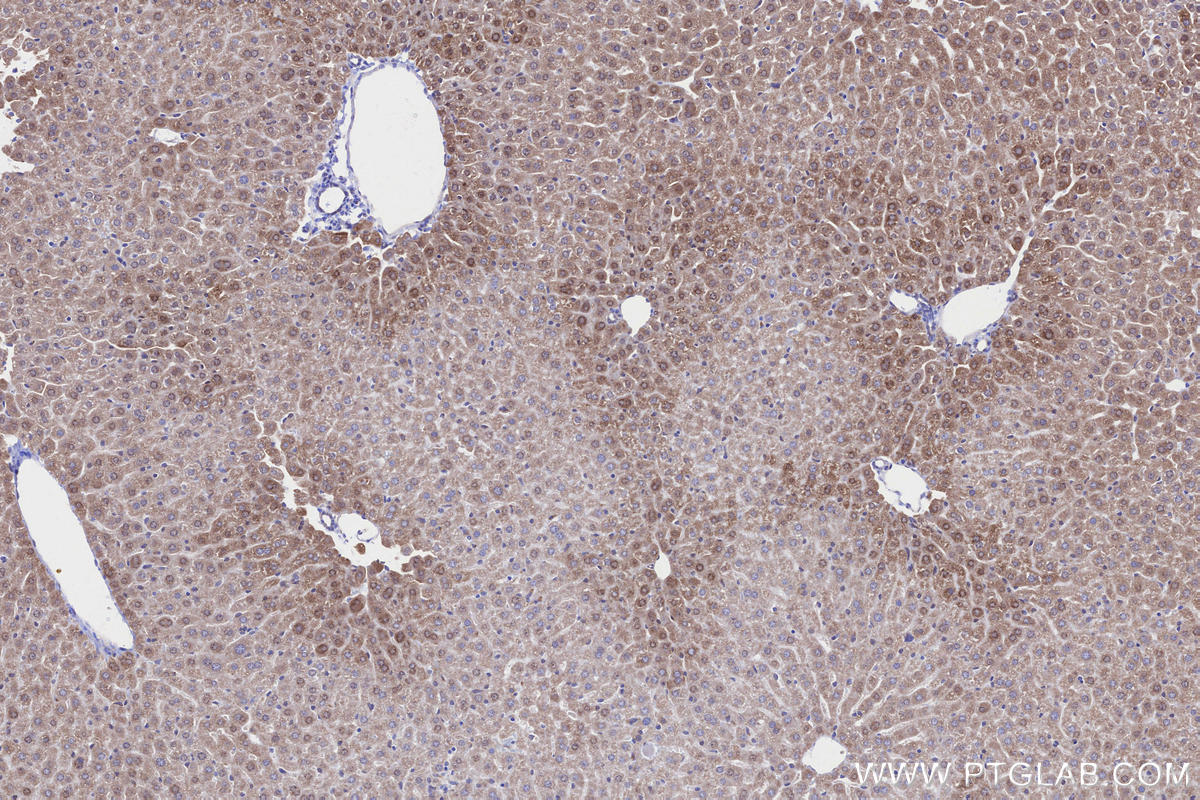 Immunohistochemistry (IHC) staining of mouse liver tissue using MIRO1 Recombinant monoclonal antibody (84055-5-RR)