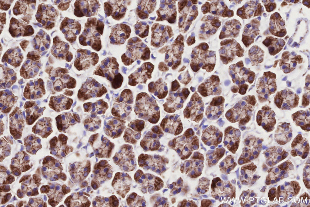 Immunohistochemistry (IHC) staining of rat stomach tissue using MIRO1 Recombinant monoclonal antibody (84055-5-RR)