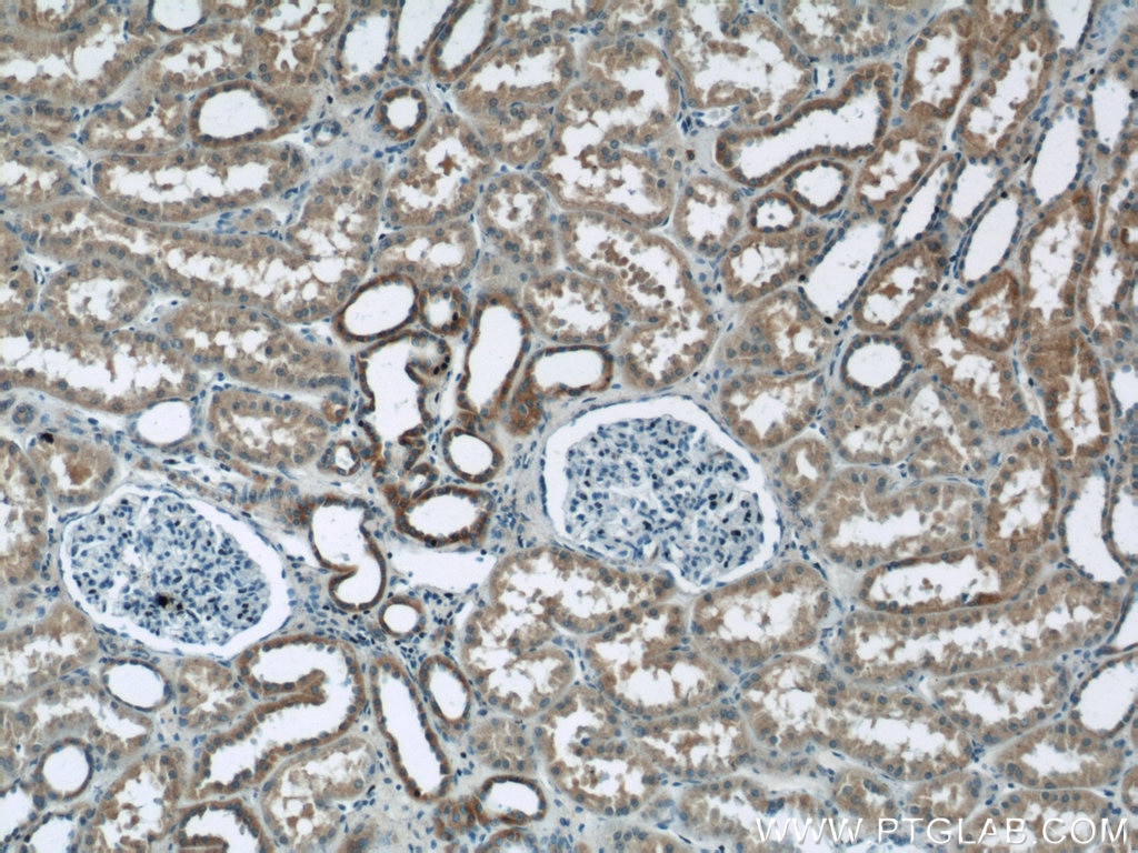 Immunohistochemistry (IHC) staining of human kidney tissue using MIRO2 Polyclonal antibody (11237-1-AP)