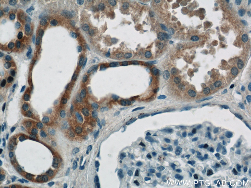 Immunohistochemistry (IHC) staining of human kidney tissue using MIRO2 Polyclonal antibody (11237-1-AP)