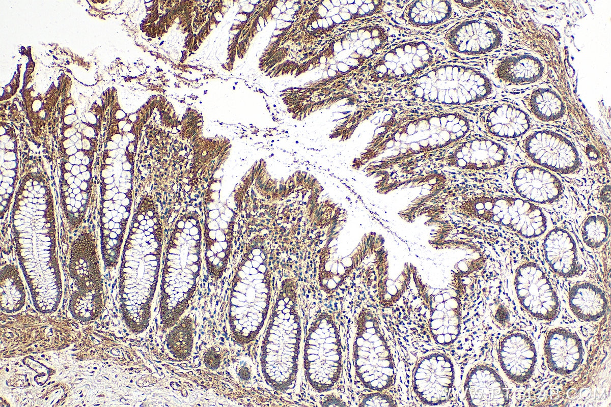 IHC staining of human colon using 11237-1-AP