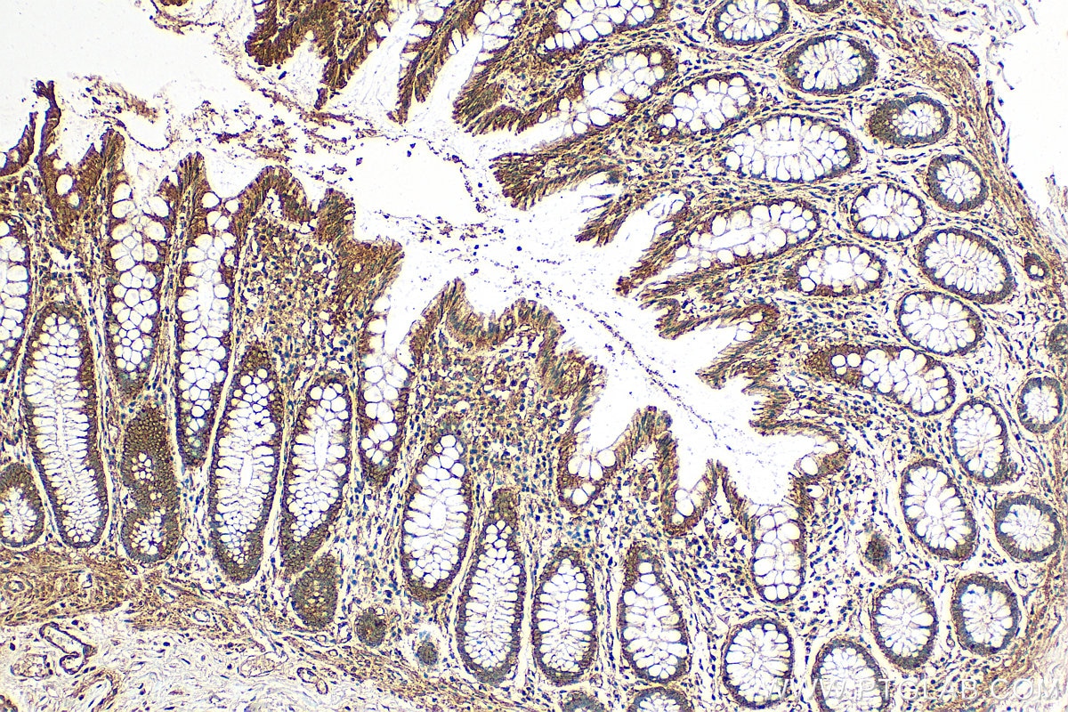 Immunohistochemistry (IHC) staining of human colon tissue using MIRO2 Polyclonal antibody (11237-1-AP)