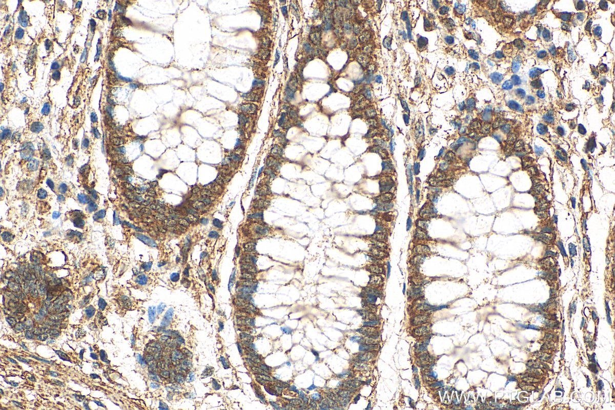Immunohistochemistry (IHC) staining of human colon tissue using MIRO2 Polyclonal antibody (11237-1-AP)