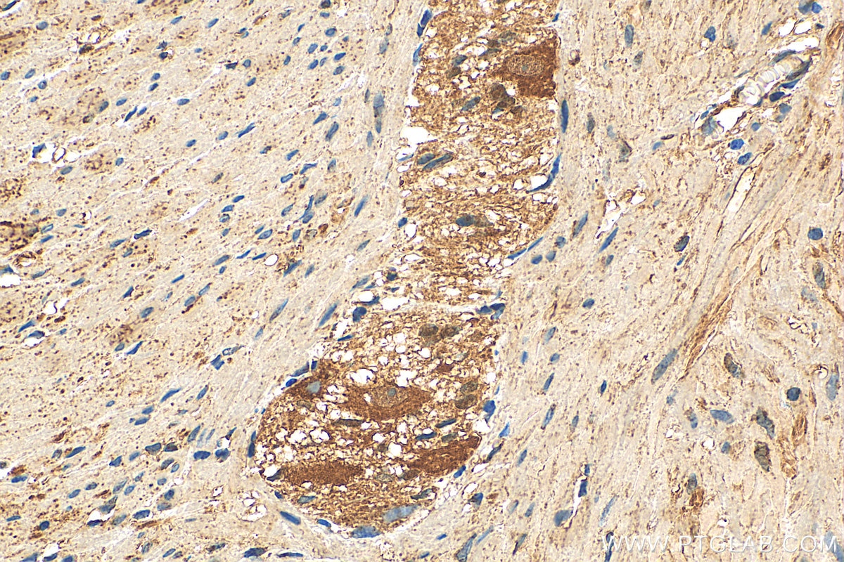 Immunohistochemistry (IHC) staining of human colon tissue using MIRO2 Polyclonal antibody (11237-1-AP)