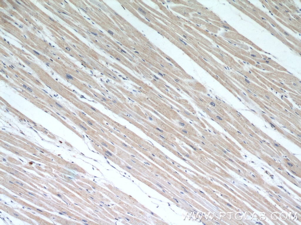 Immunohistochemistry (IHC) staining of human heart tissue using MIRO2 Polyclonal antibody (11237-1-AP)