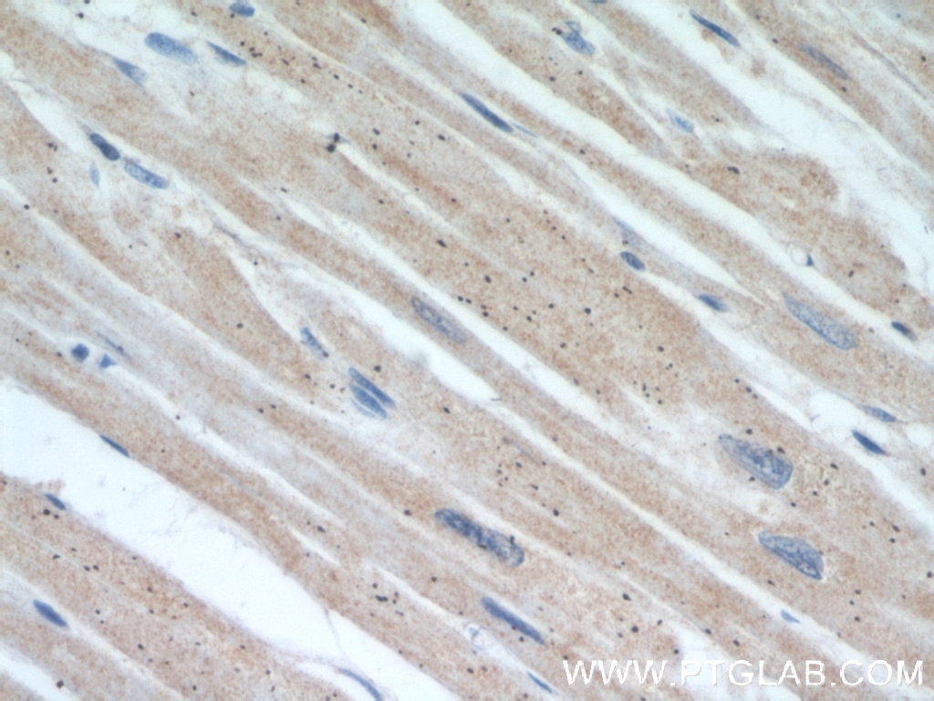 IHC staining of human heart using 11237-1-AP