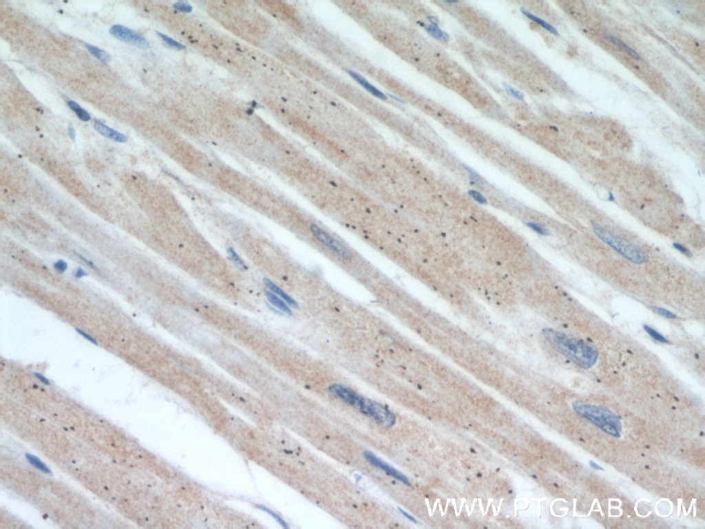 Immunohistochemistry (IHC) staining of human heart tissue using MIRO2 Polyclonal antibody (11237-1-AP)