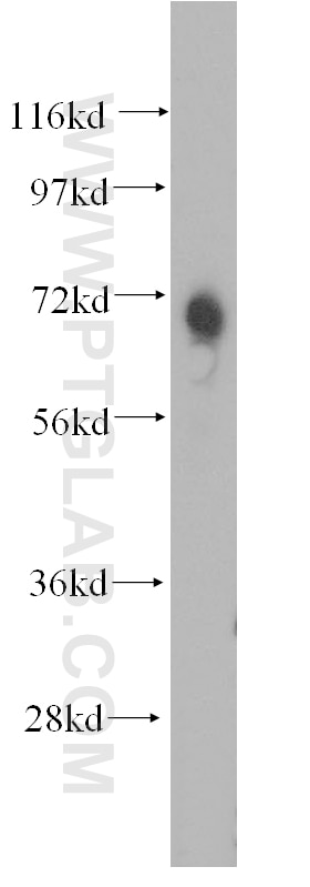 Western Blot (WB) analysis of human kidney tissue using MIRO2 Polyclonal antibody (11237-1-AP)