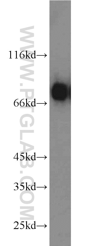 Western Blot (WB) analysis of human testis tissue using MIRO2 Polyclonal antibody (11237-1-AP)
