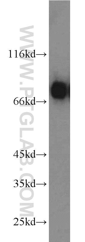 WB analysis of human testis using 11237-1-AP