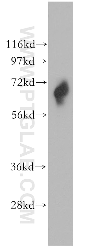 Western Blot (WB) analysis of human heart tissue using MIRO2 Polyclonal antibody (11237-1-AP)